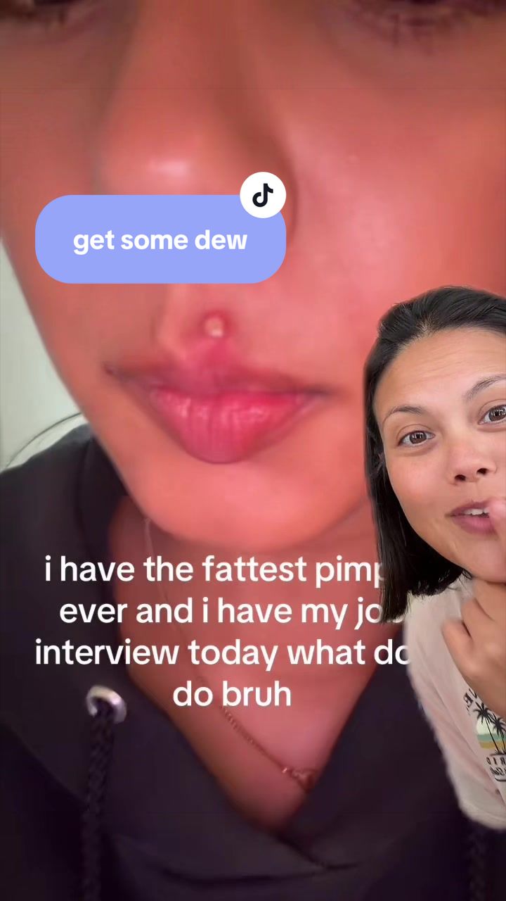 @dewmighty