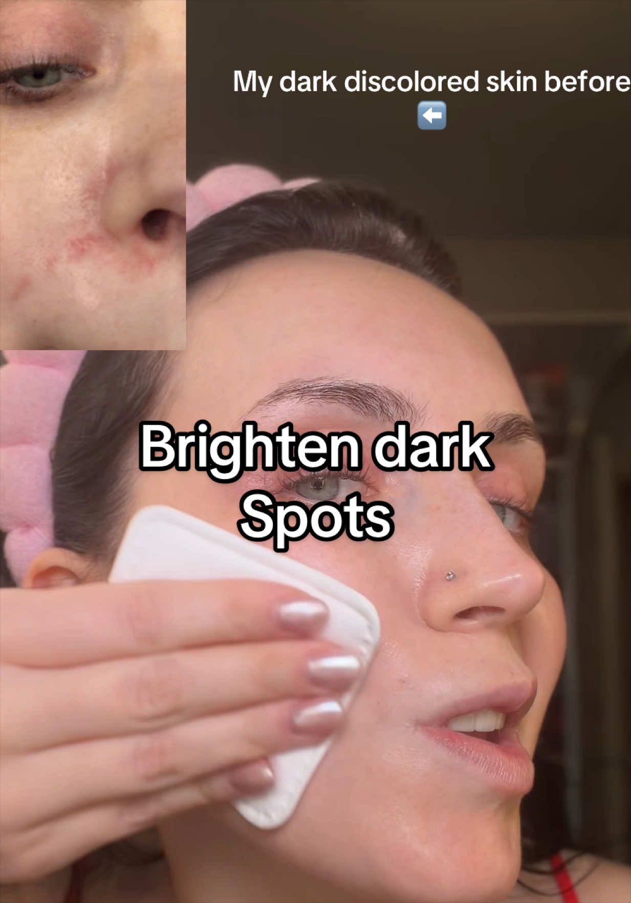 @KC