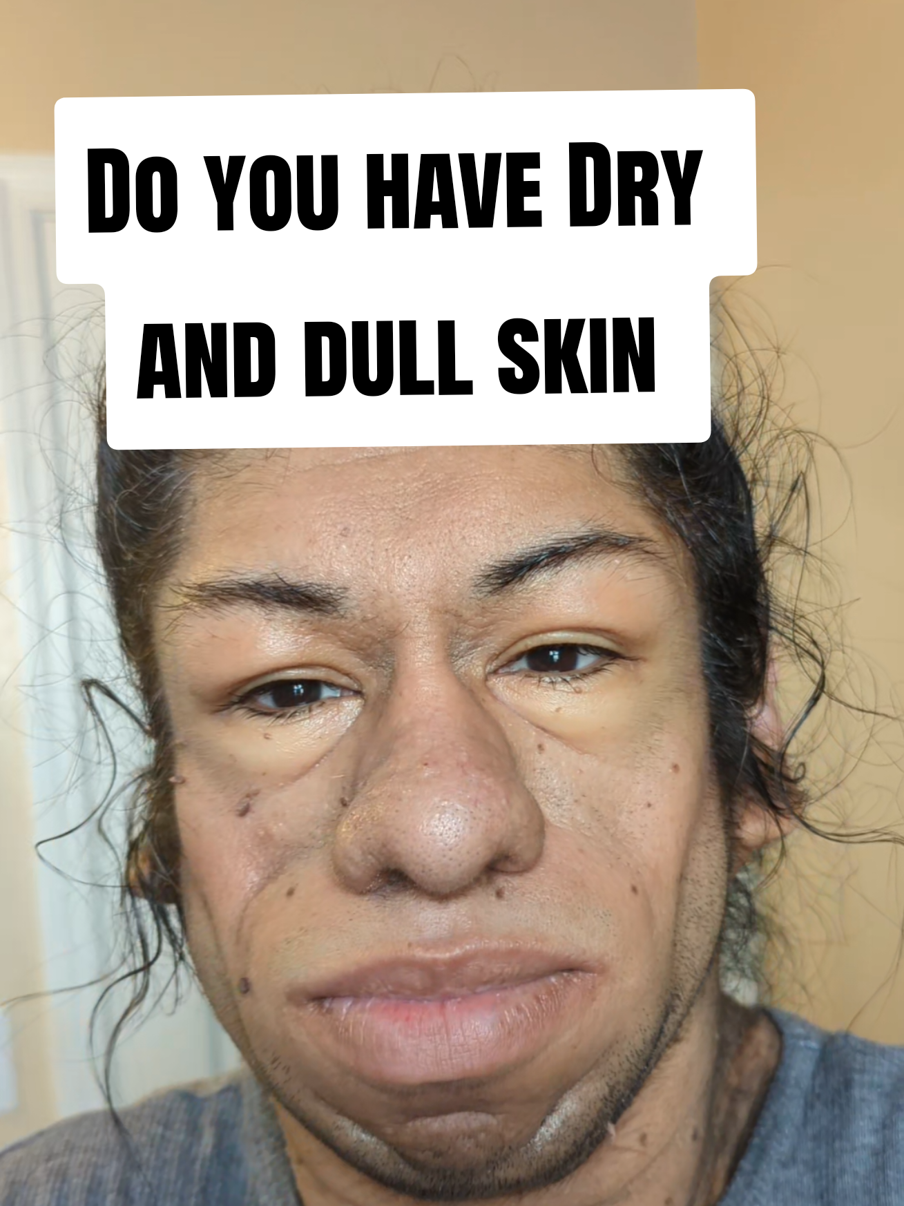 @Yessimperfections