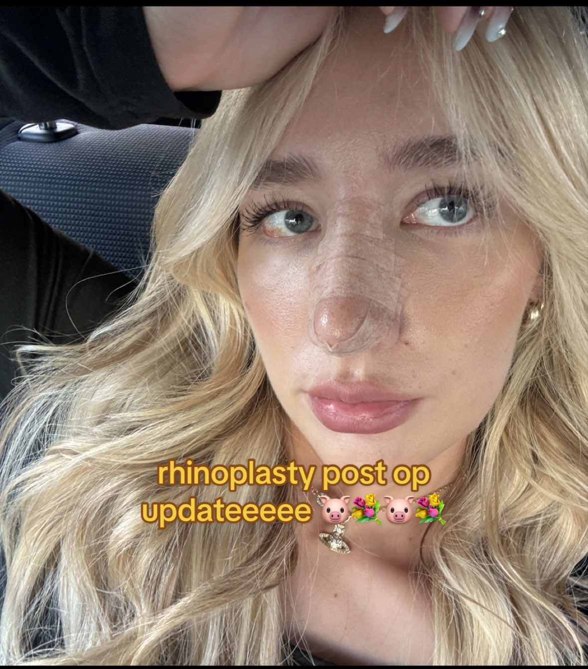 @chloee marie lindsay