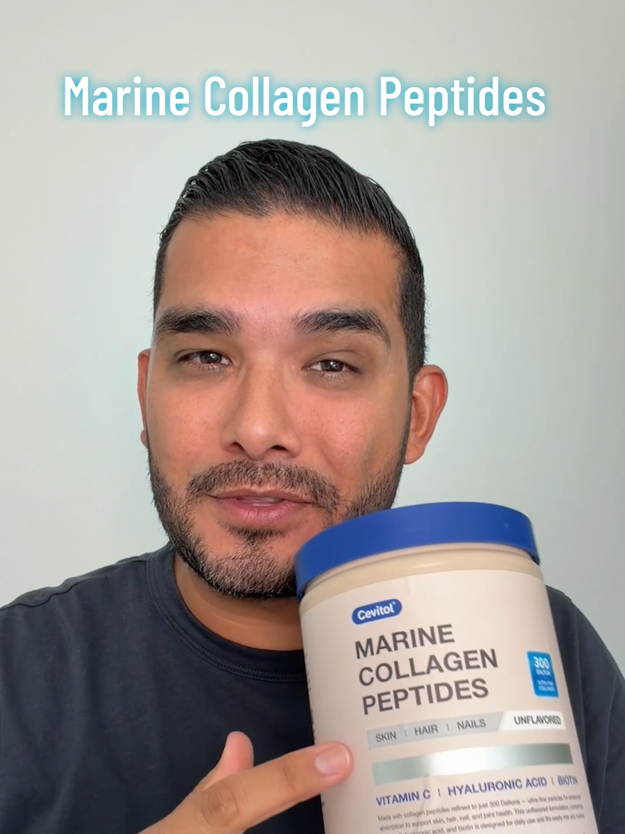 @Esteban