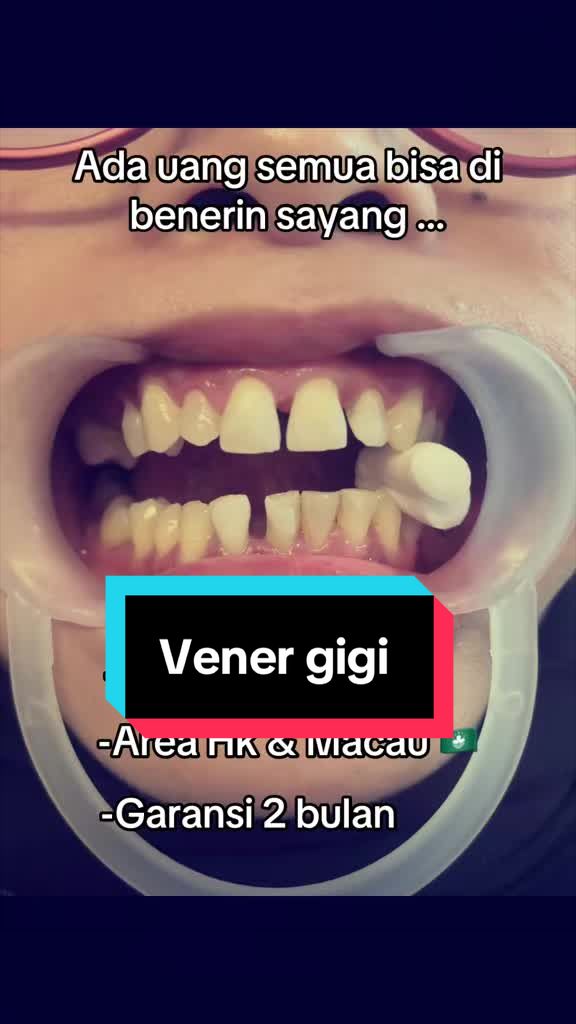 @mbak-Paijem