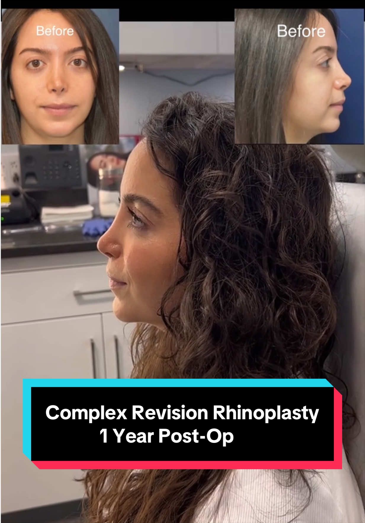 @Dr. Richard Reish, M.D., FACS