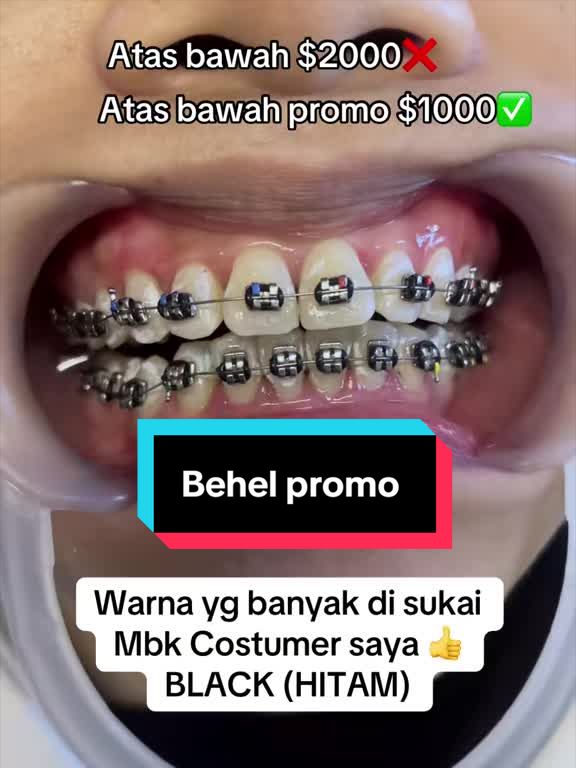 @mbak-Paijem