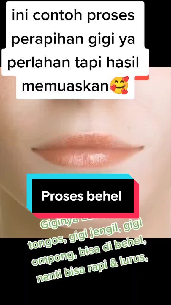 @mbak-Paijem