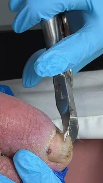 @Deniel Foot and Ankle Center