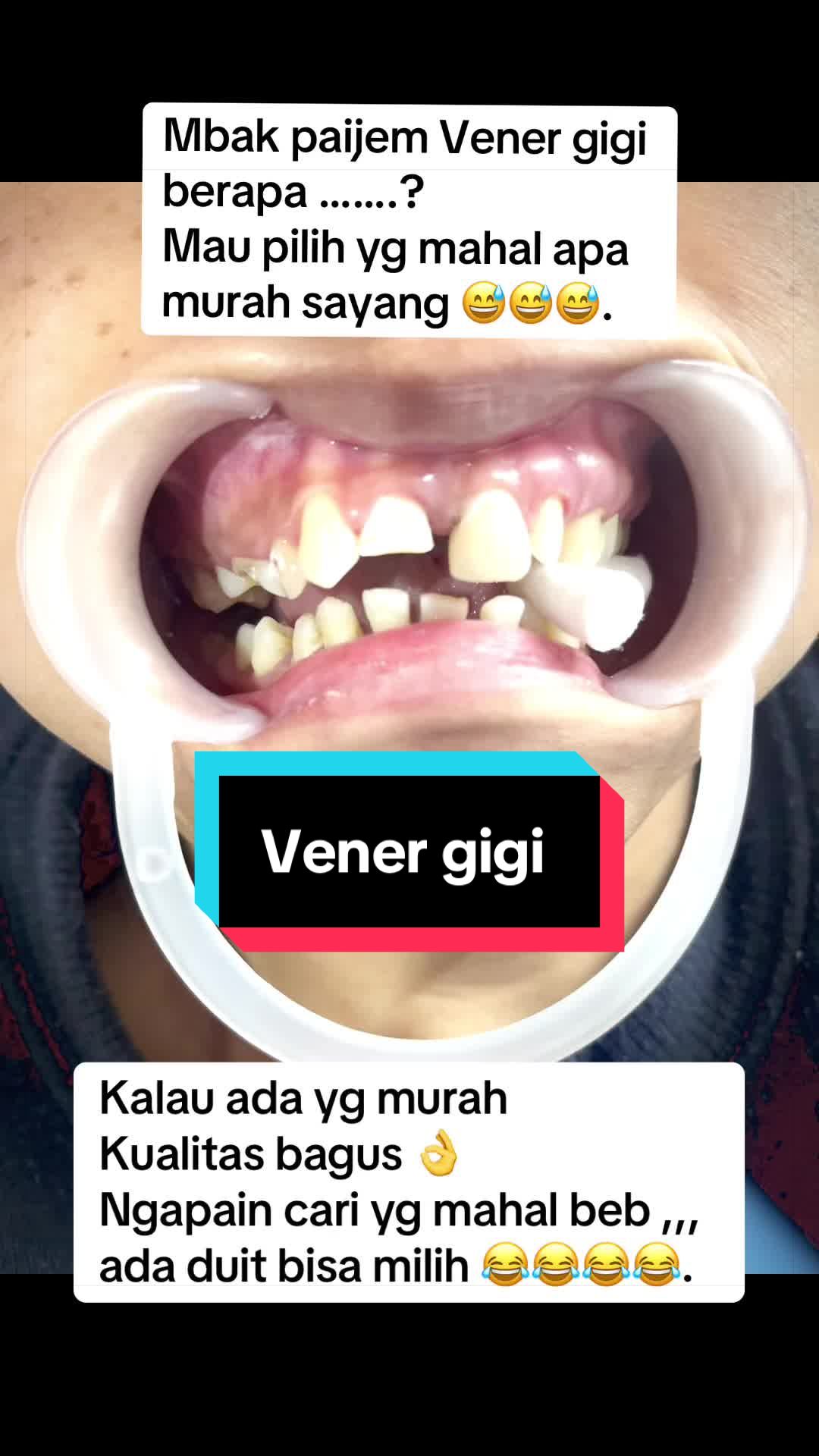 @mbak-Paijem