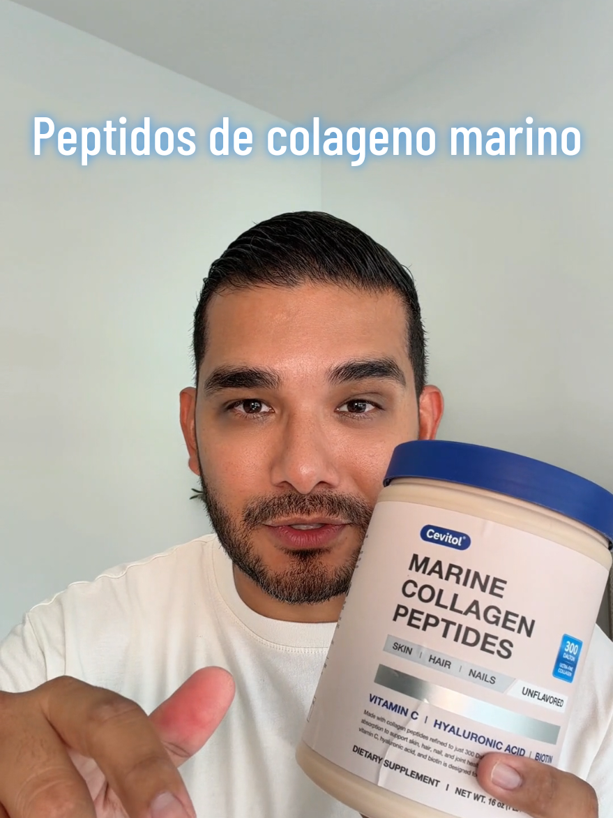 @Esteban