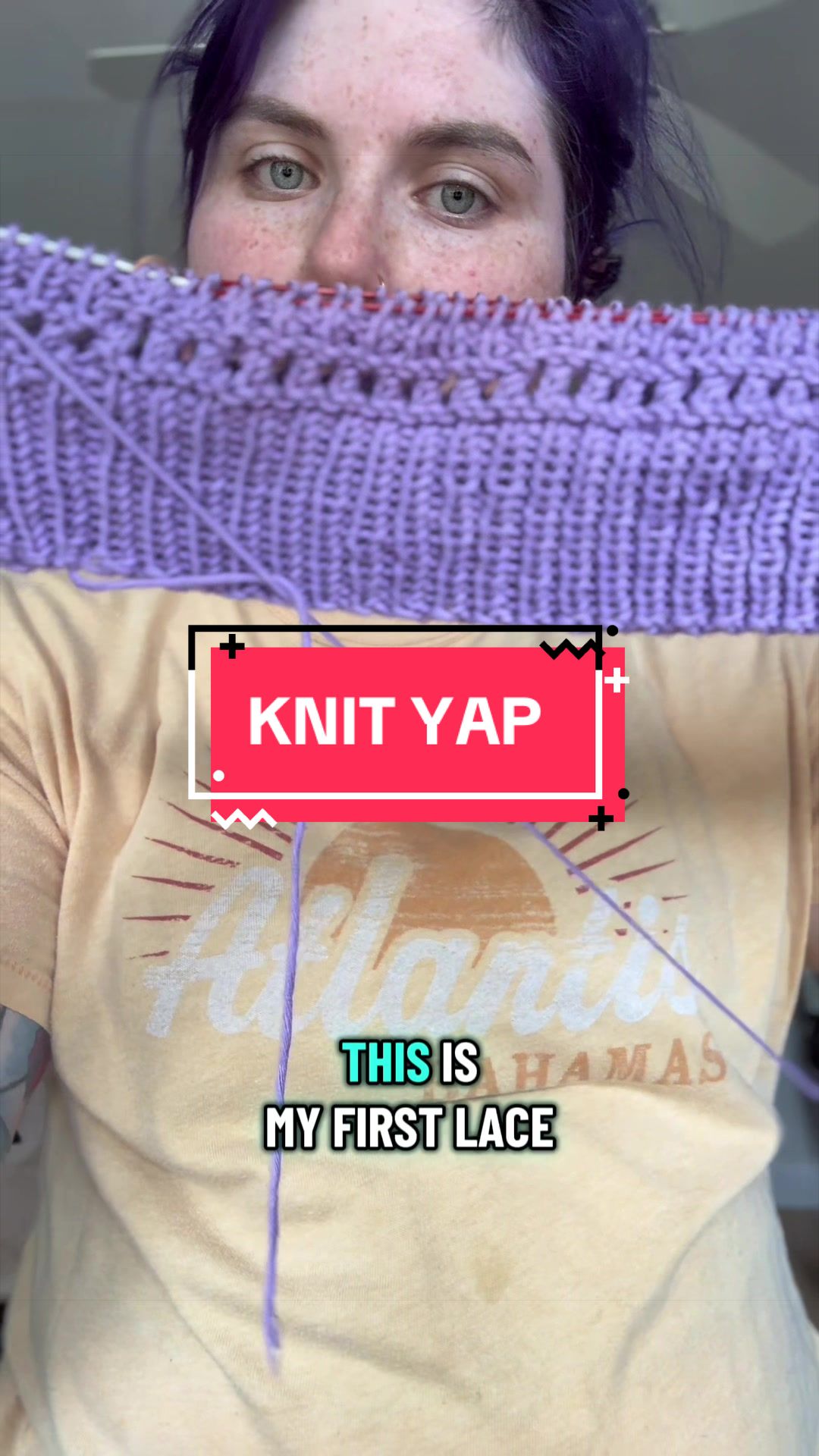 @Allie 🧶🫍✨