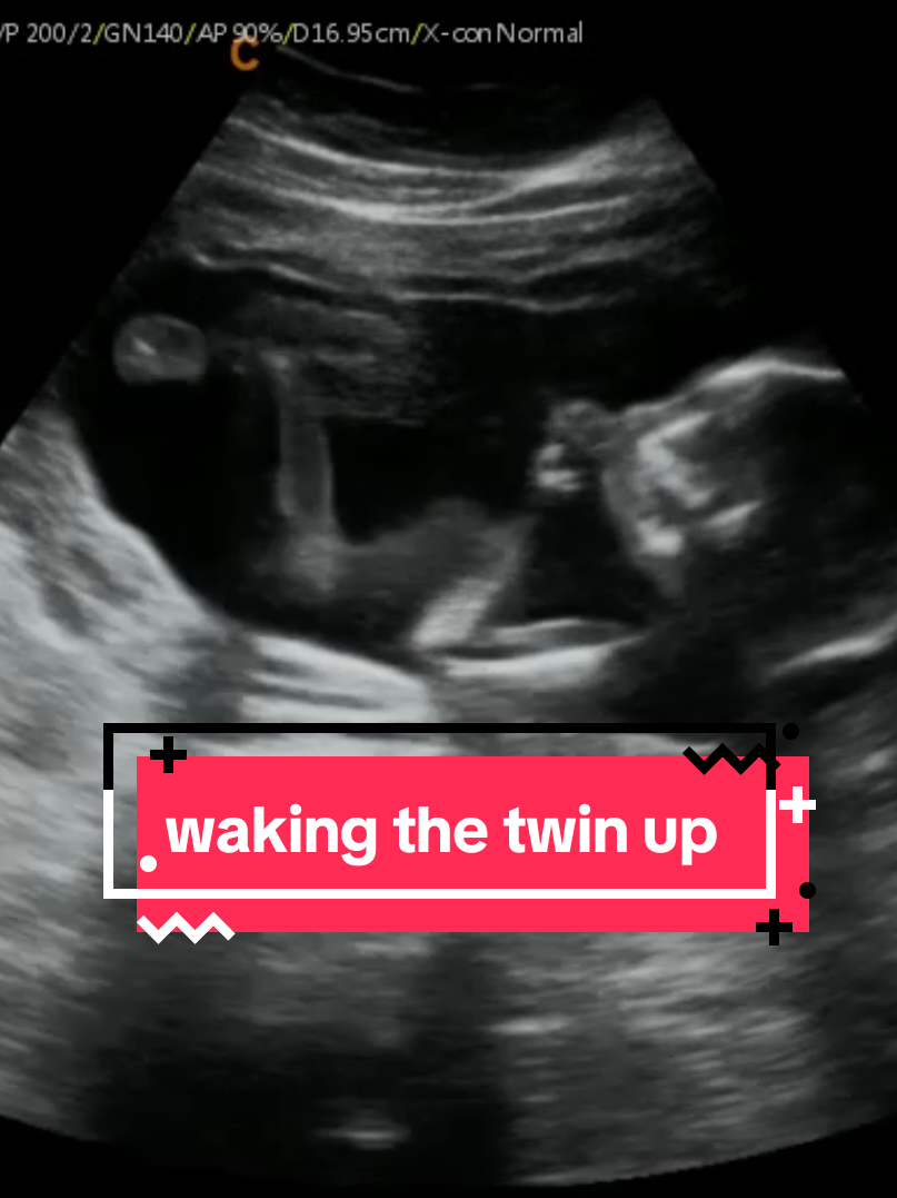 @Hey, Baby!