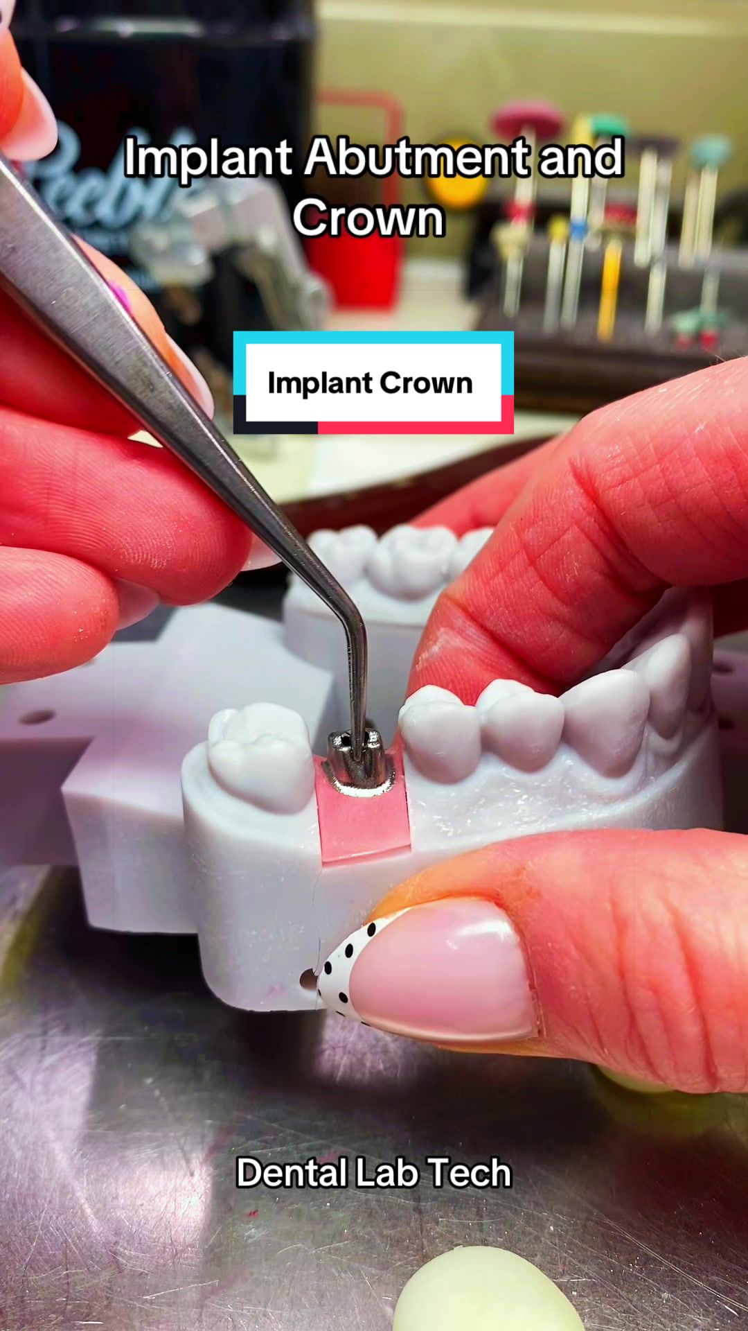 @Dental Tech Hey Jey