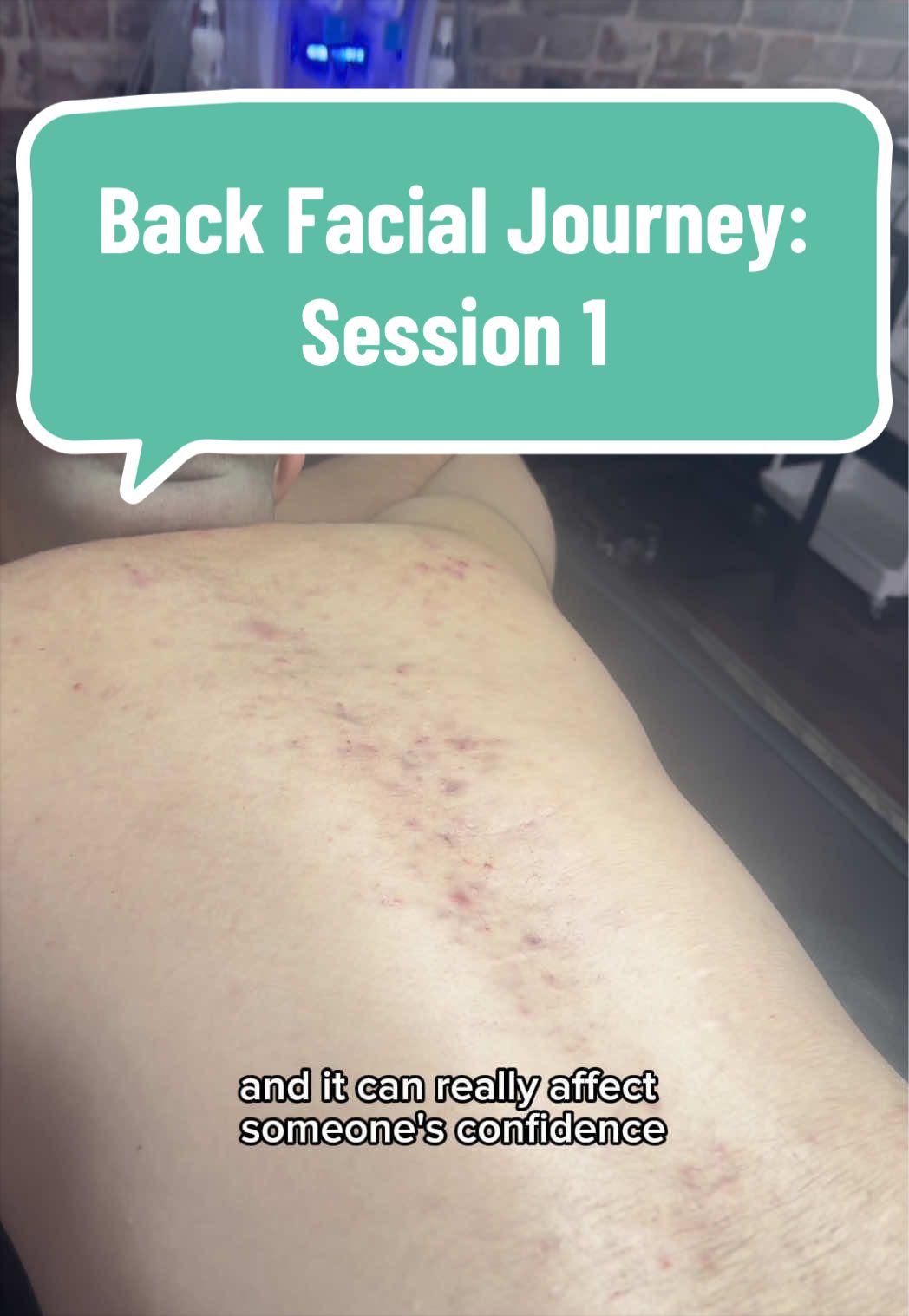 @Lisett Dalhart TX Esthetician