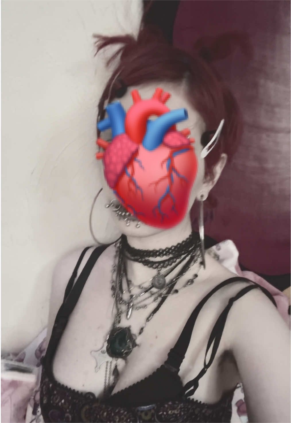 @miyaisdead
