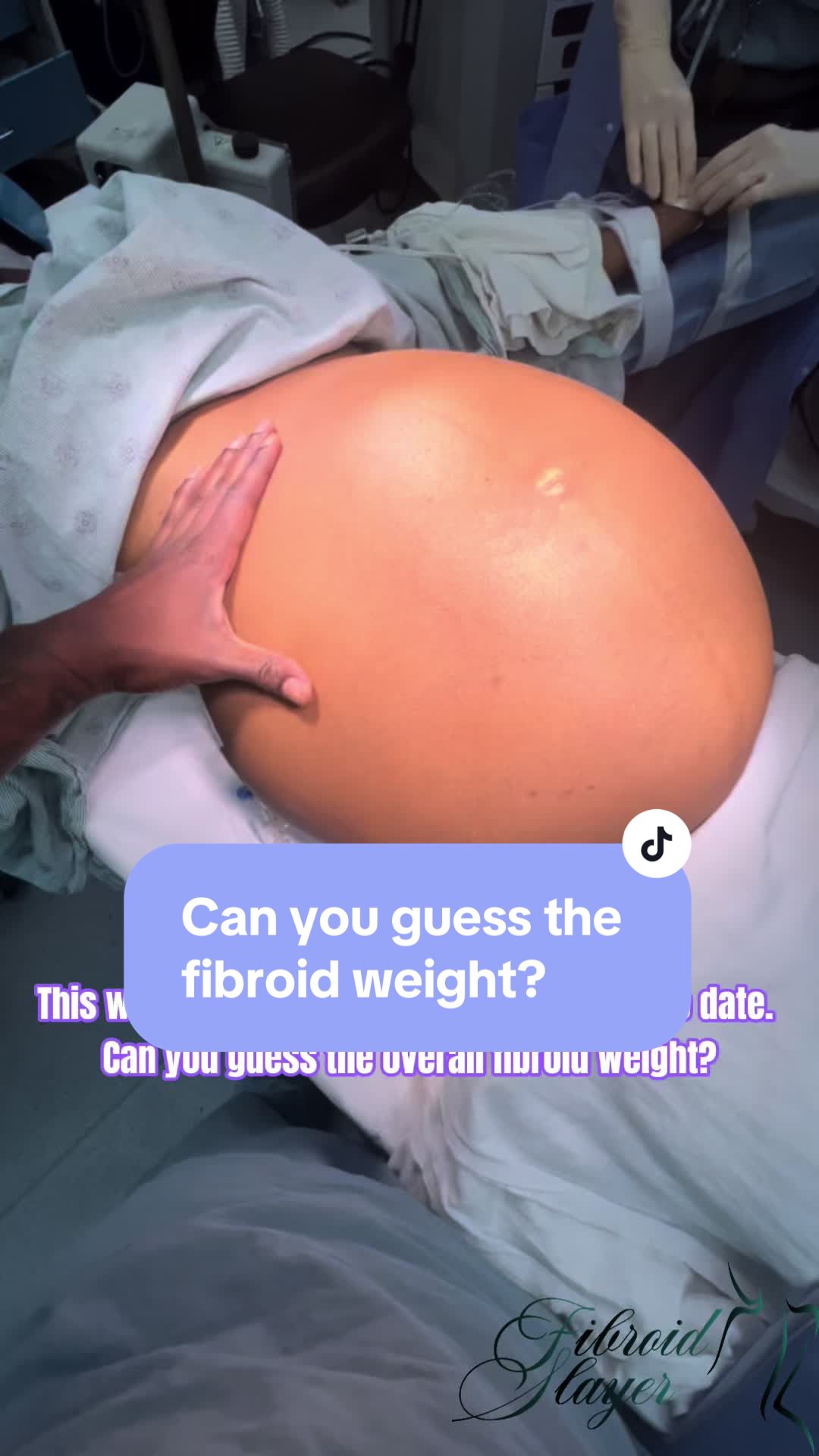 @Pierre Johnson, MD, FACOG