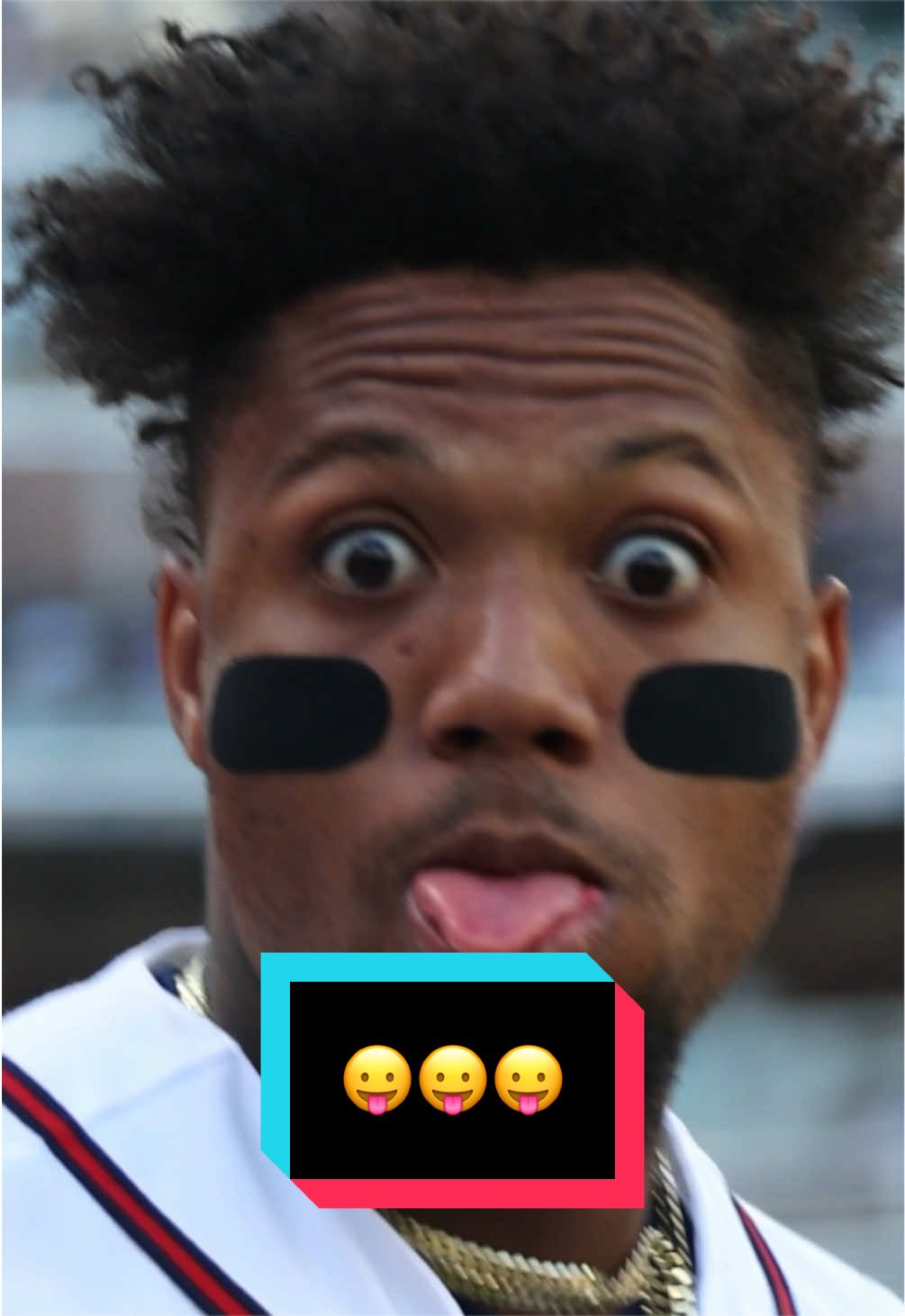 @MLB