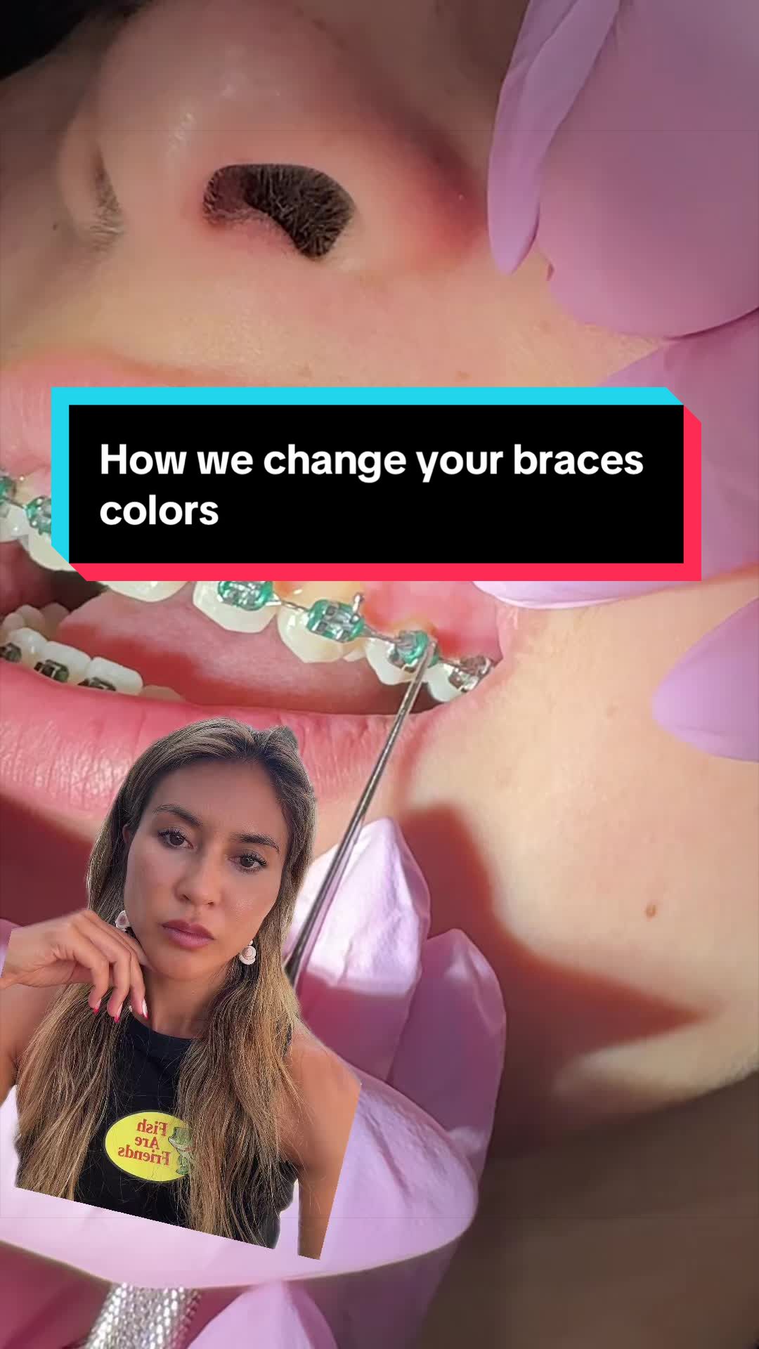 @Cara Hodgson DDS, MS