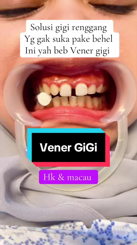 @mbak-Paijem