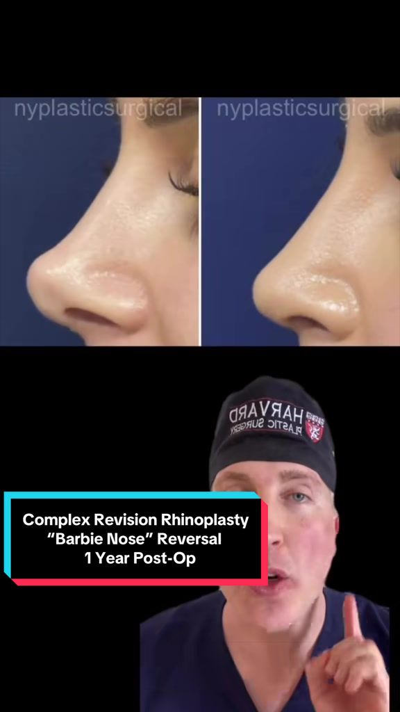 @Dr. Richard Reish, M.D., FACS