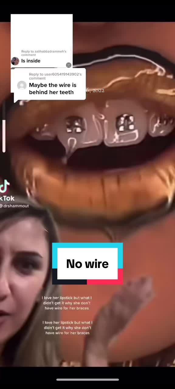@ðððð ðð¡ððŠðŠðšð®ð ðDS