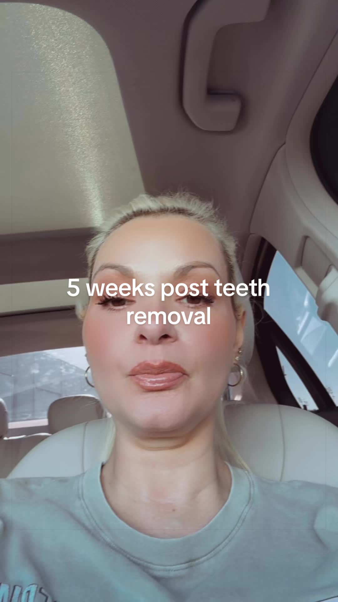 @DentureDiaries