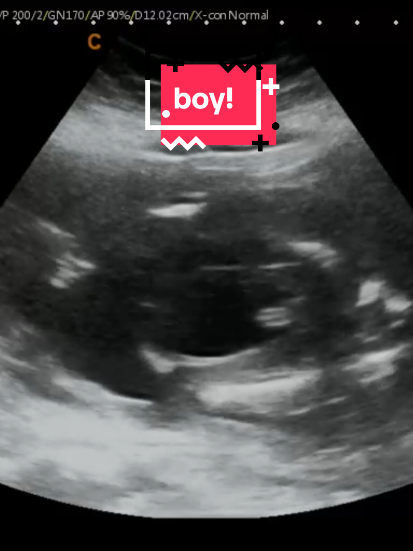 @Hey, Baby!
