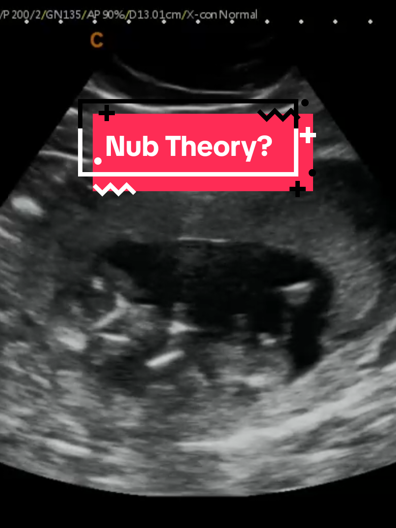 @Hey, Baby!