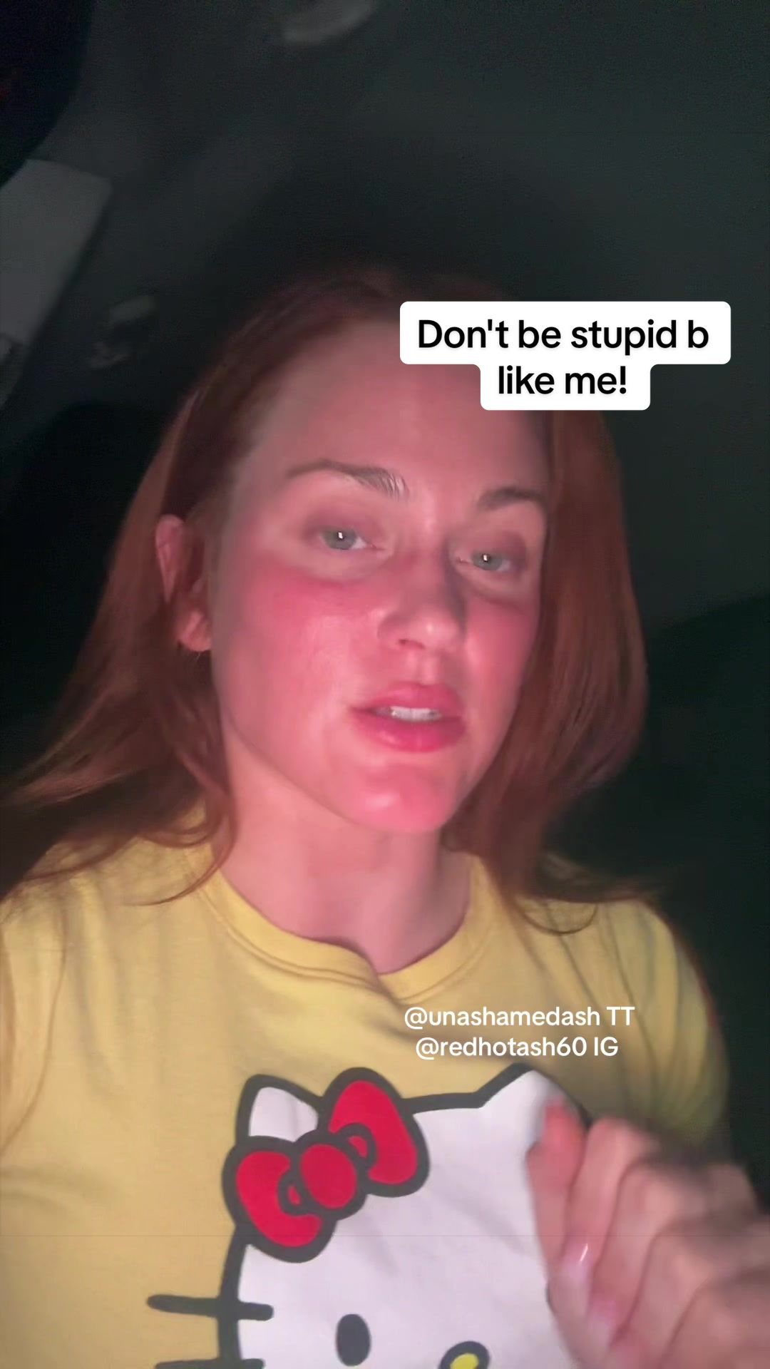 @Unashamed