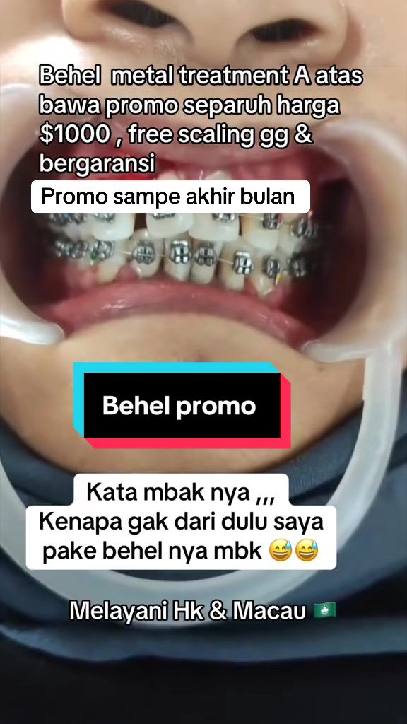 @mbak-Paijem