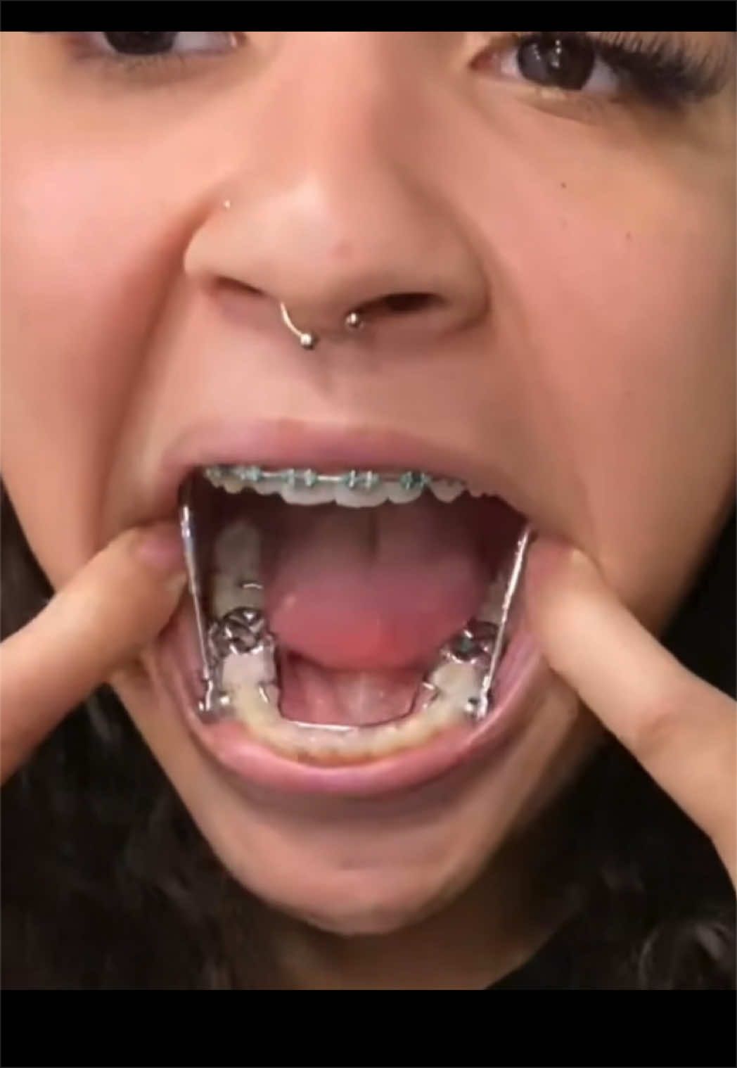 @aaaaa