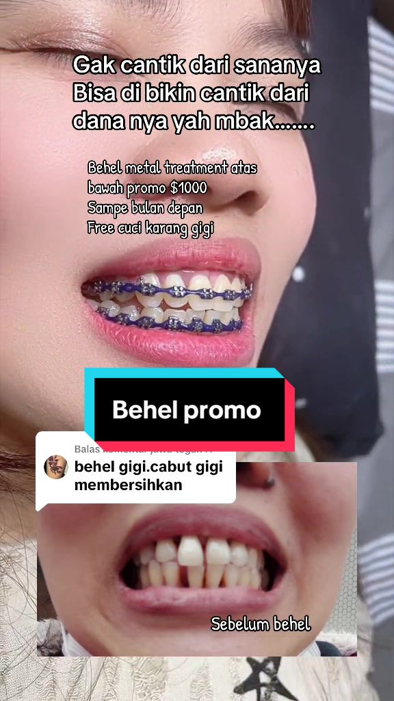 @mbak-Paijem