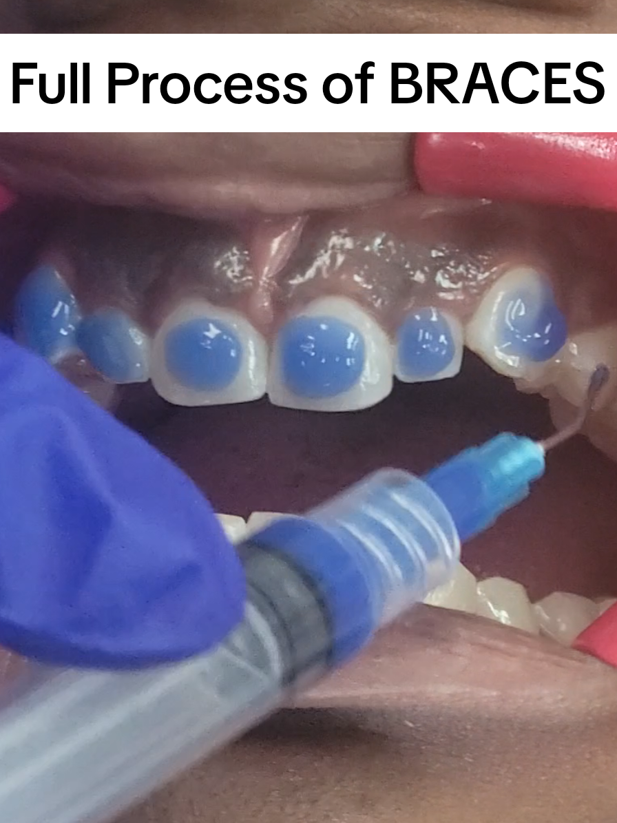 @SmileEnvyDental