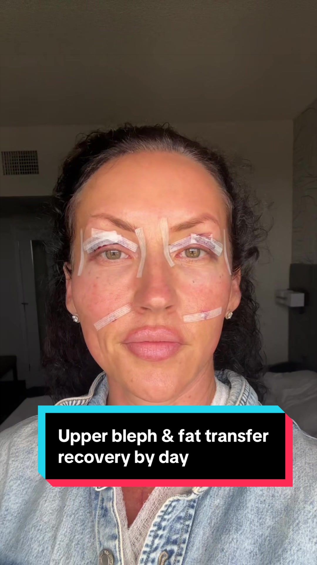 @KymChase