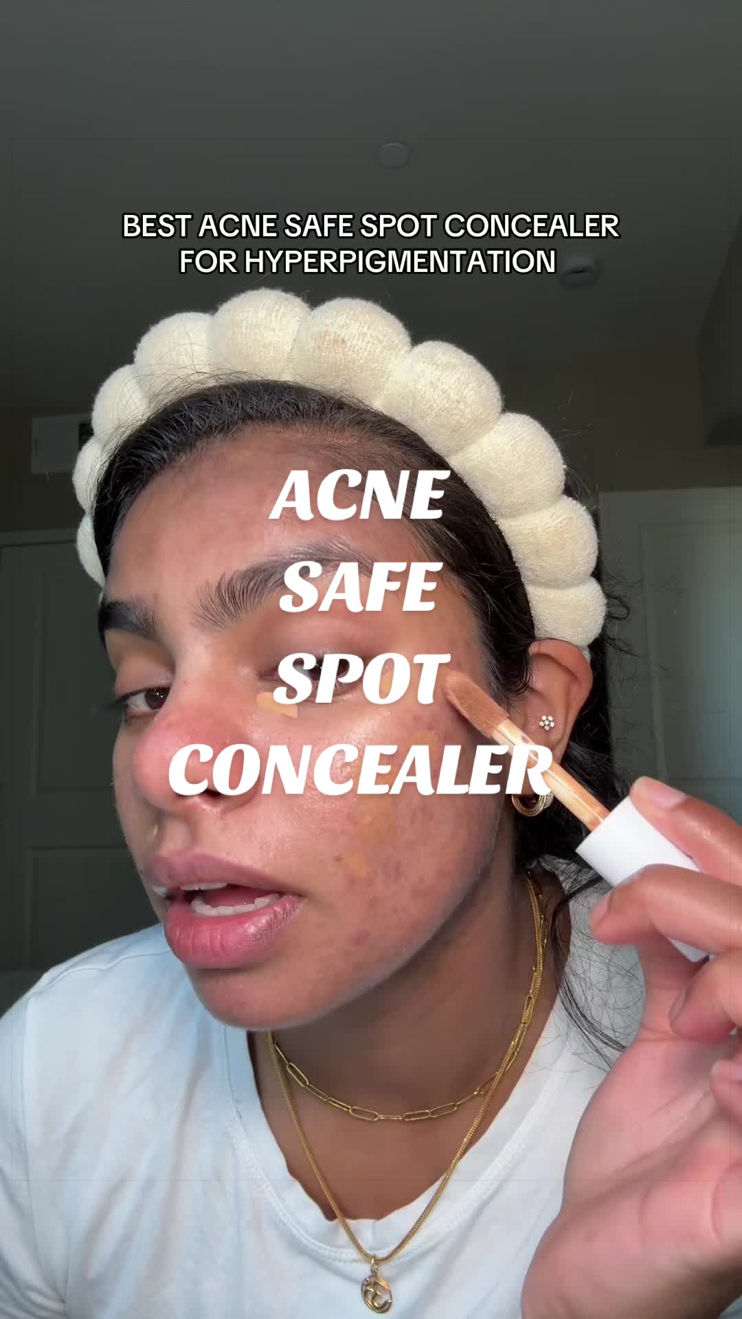 @Nyx Curations | Acne +Wellness