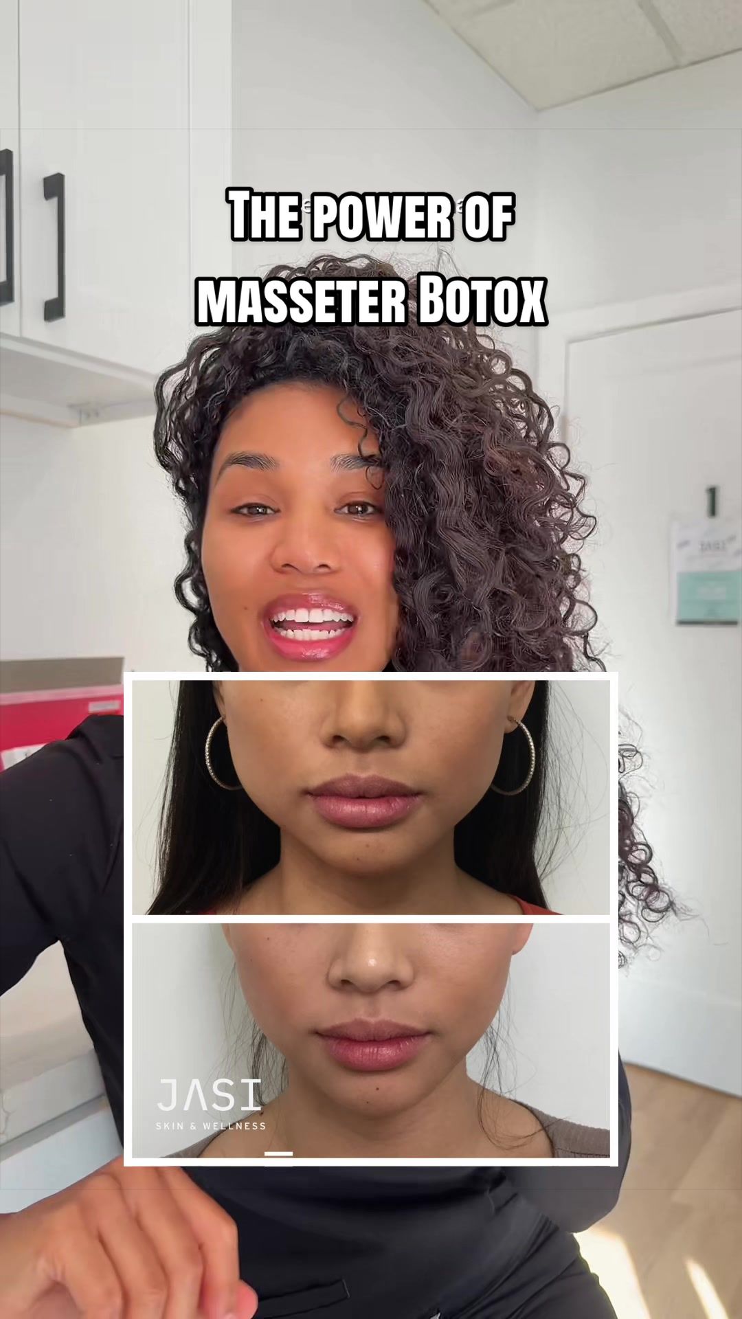 @Botox Filler Skin Los Angeles
