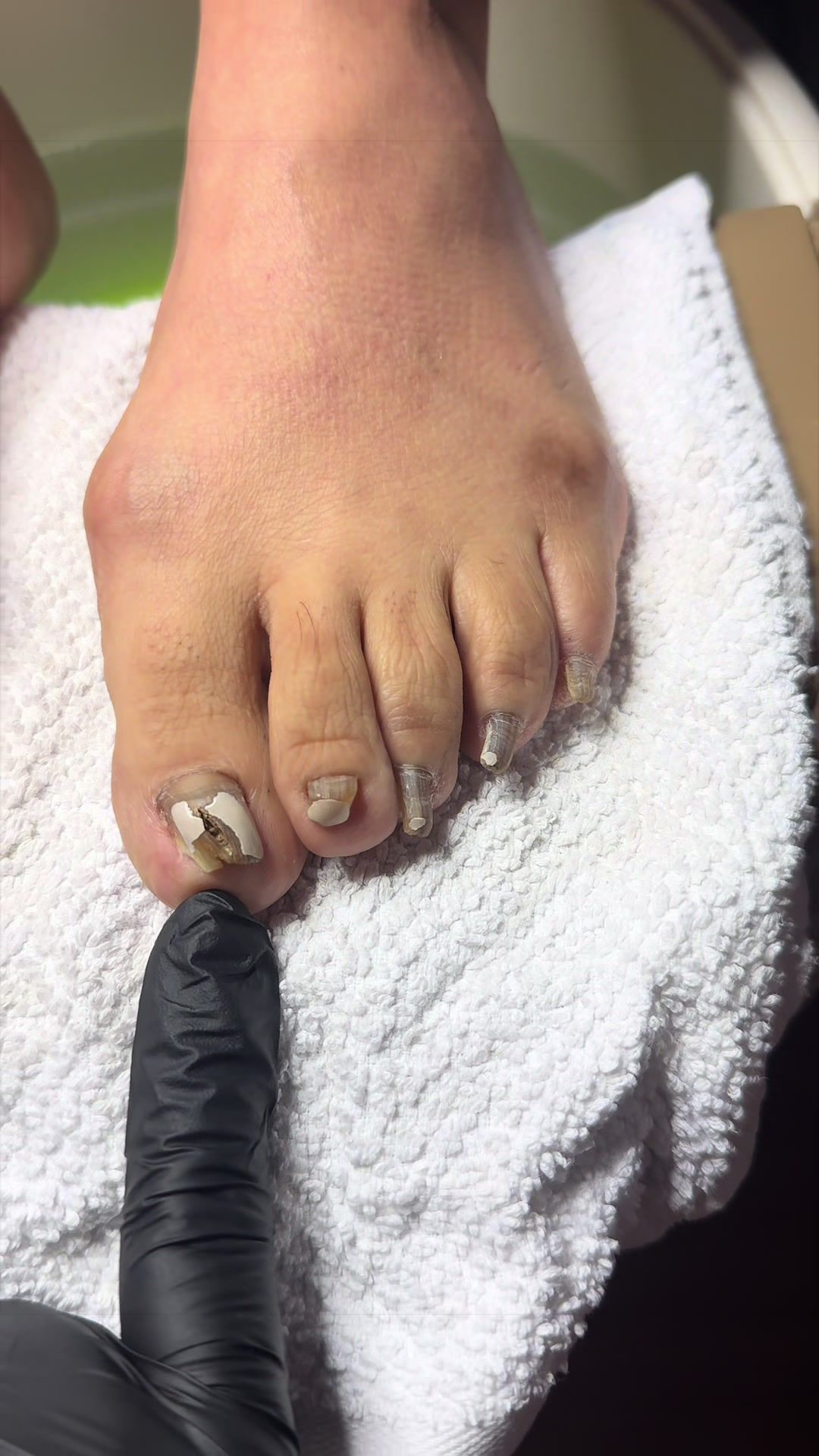 @ToesbyKoki