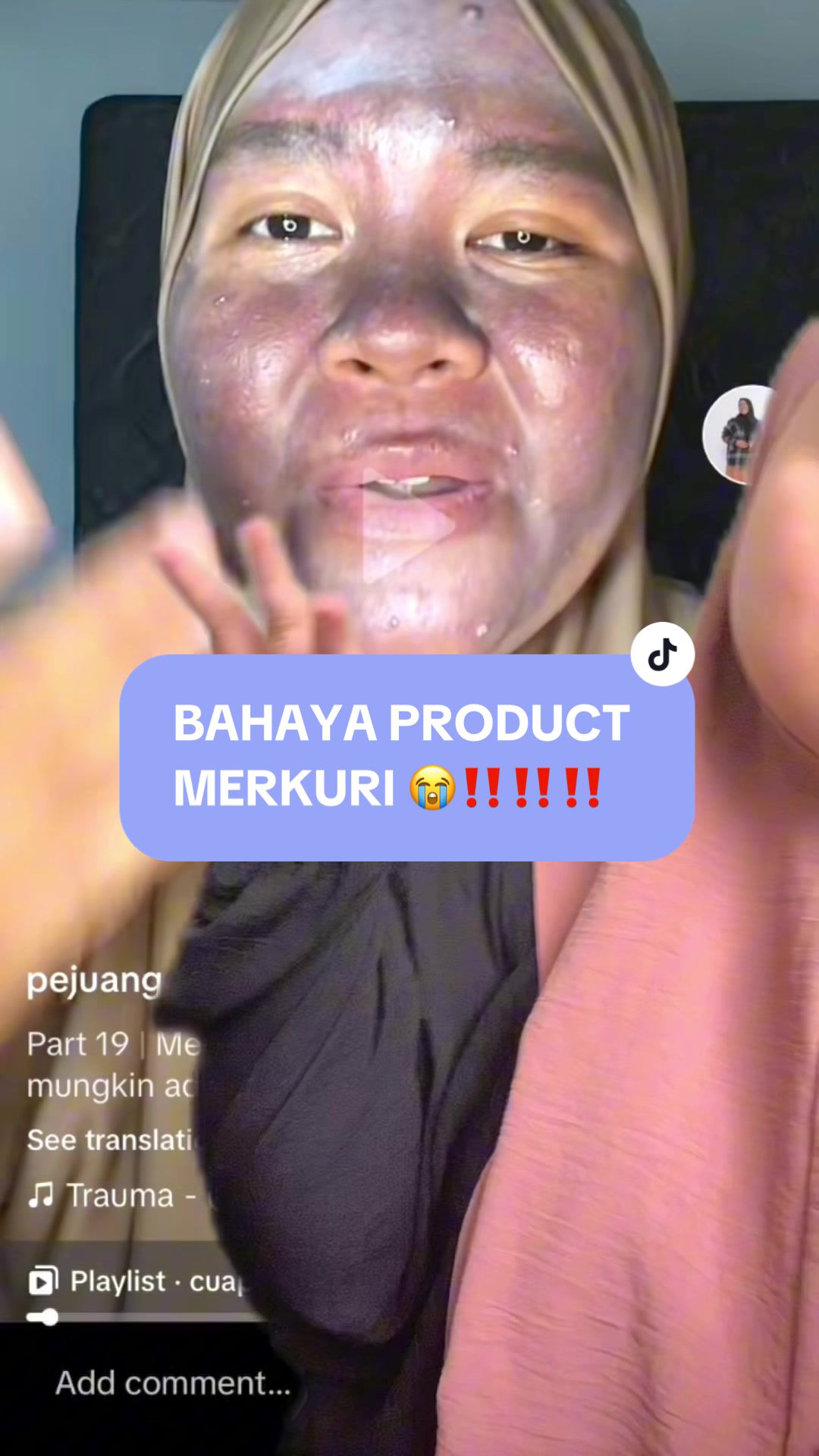 @Mervably Skin