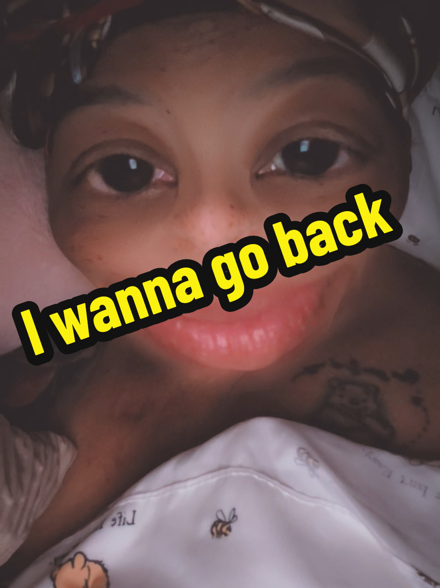 @Freckle Face