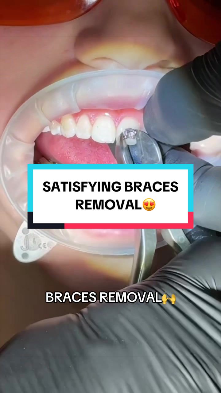 @TikTok Dentist