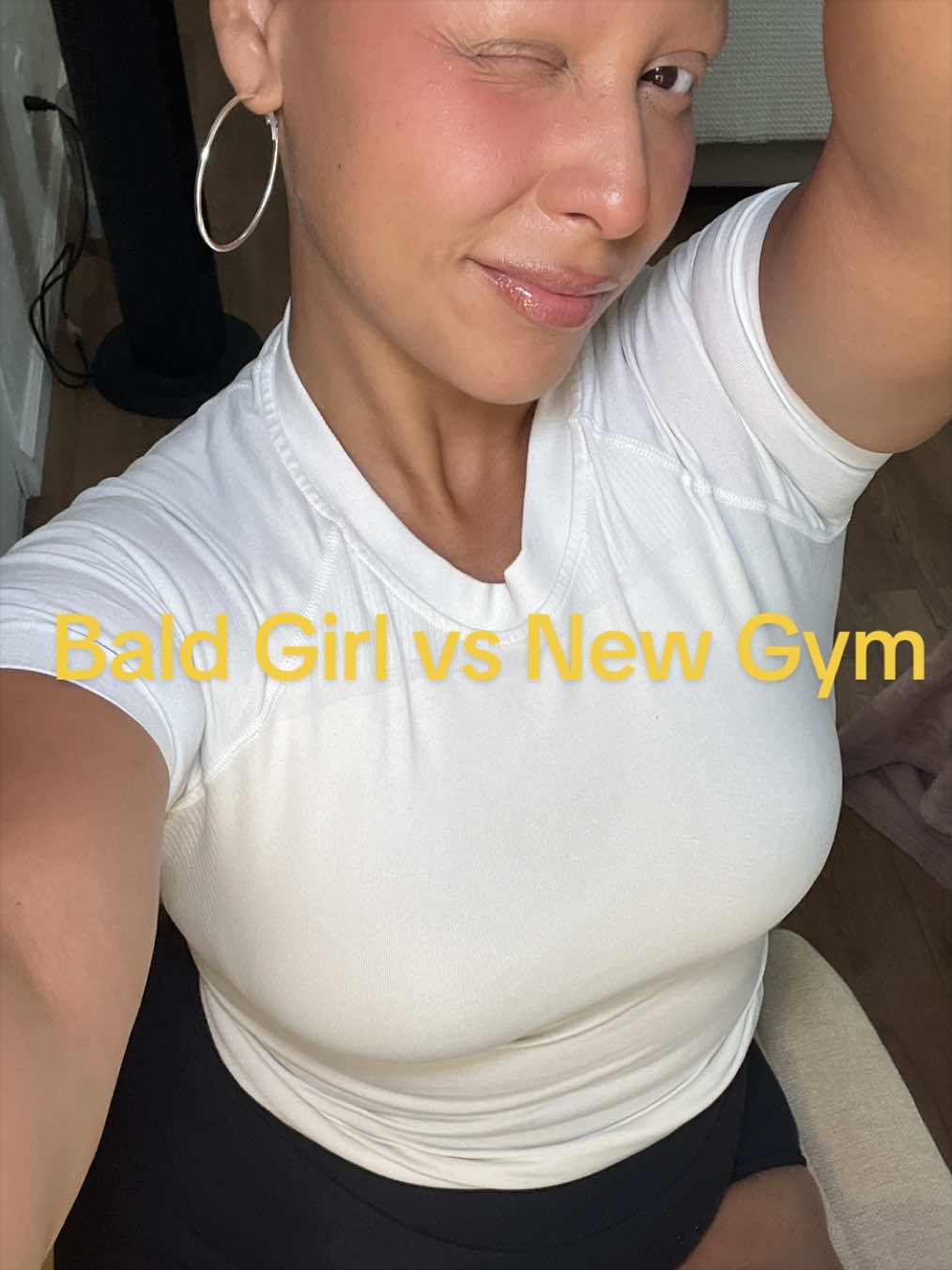 @AlopecianPrincess
