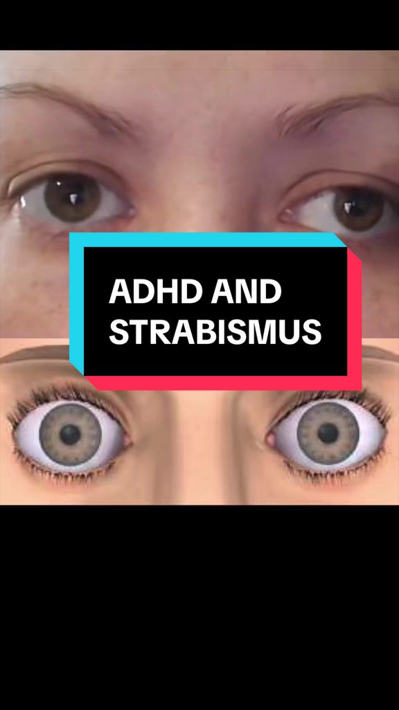 @Vivid Visions Optometry, Inc