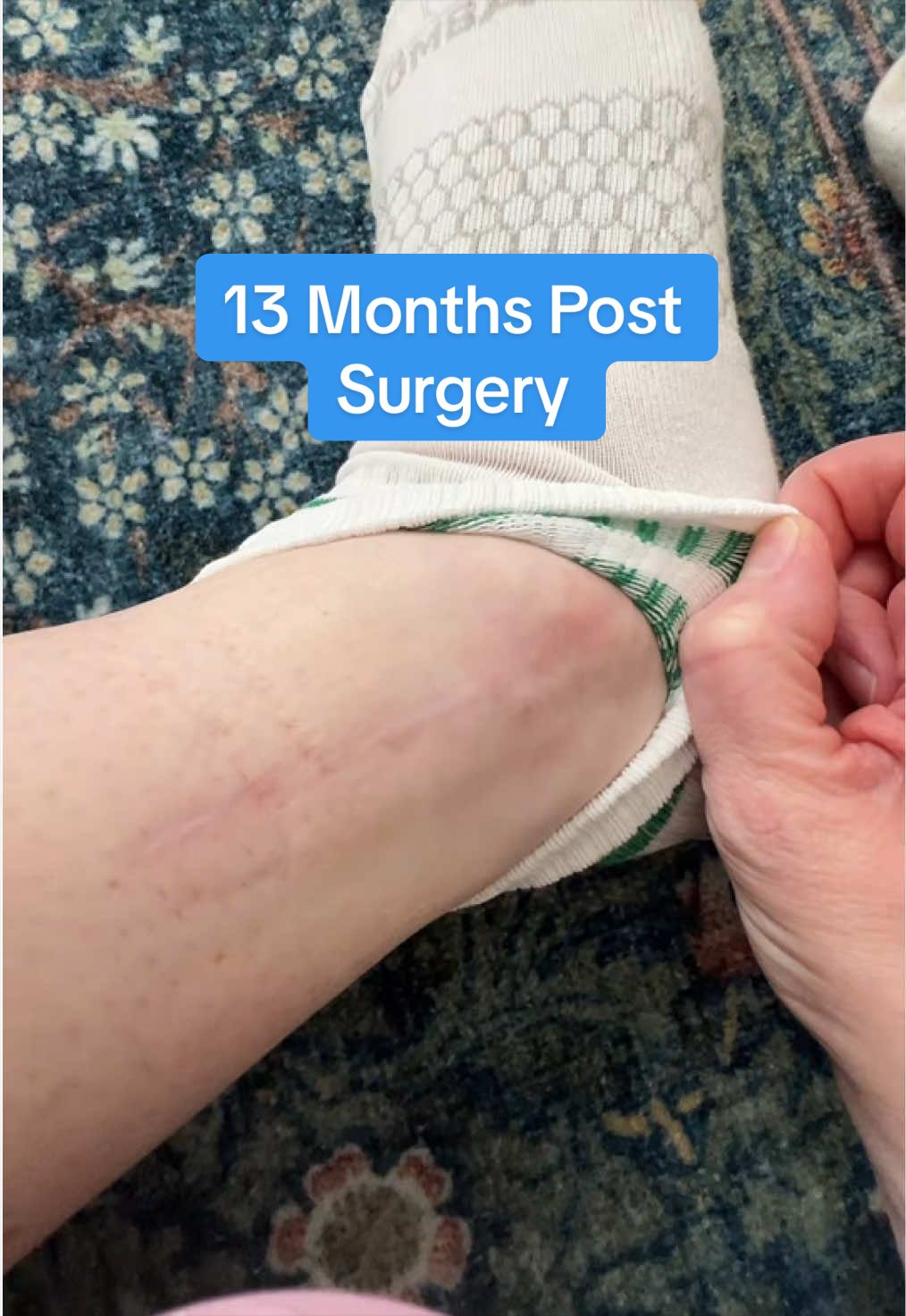 @MelanomaMom