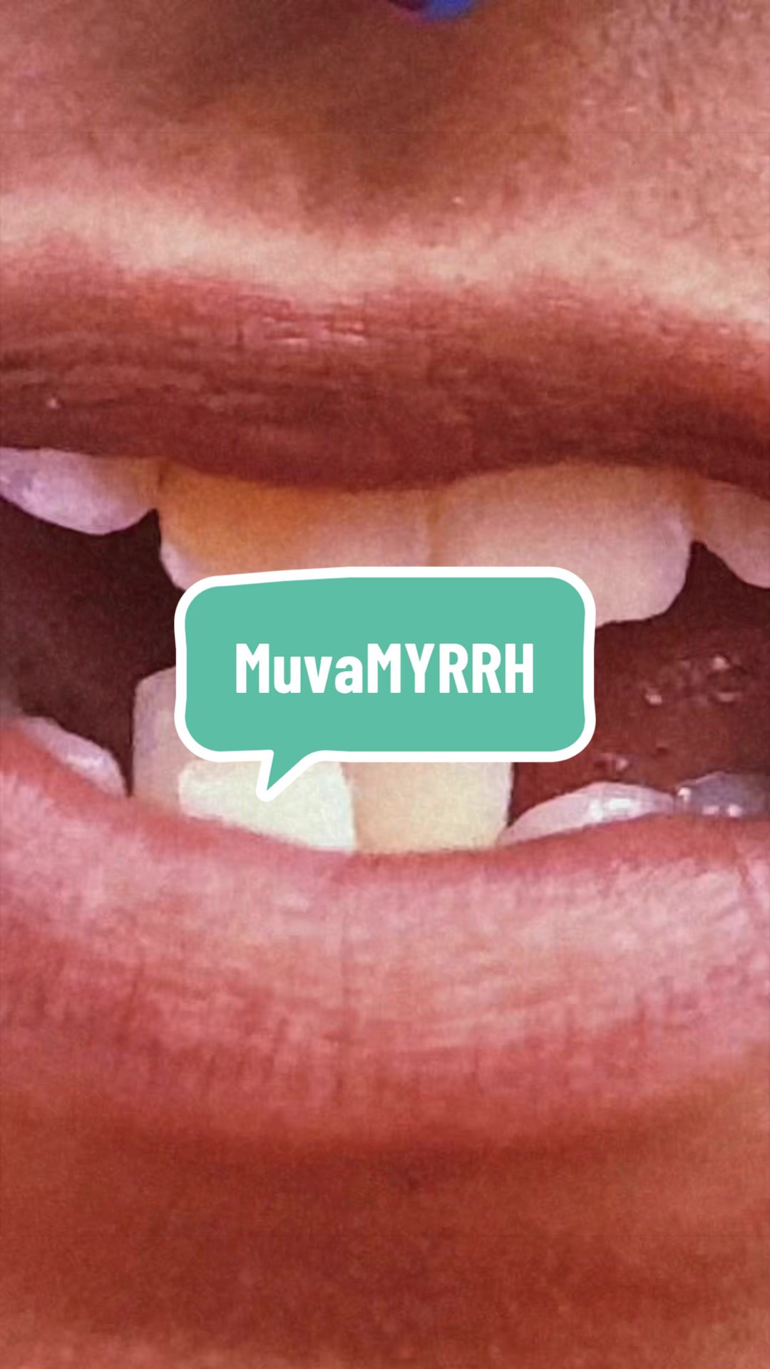 @Myrrh