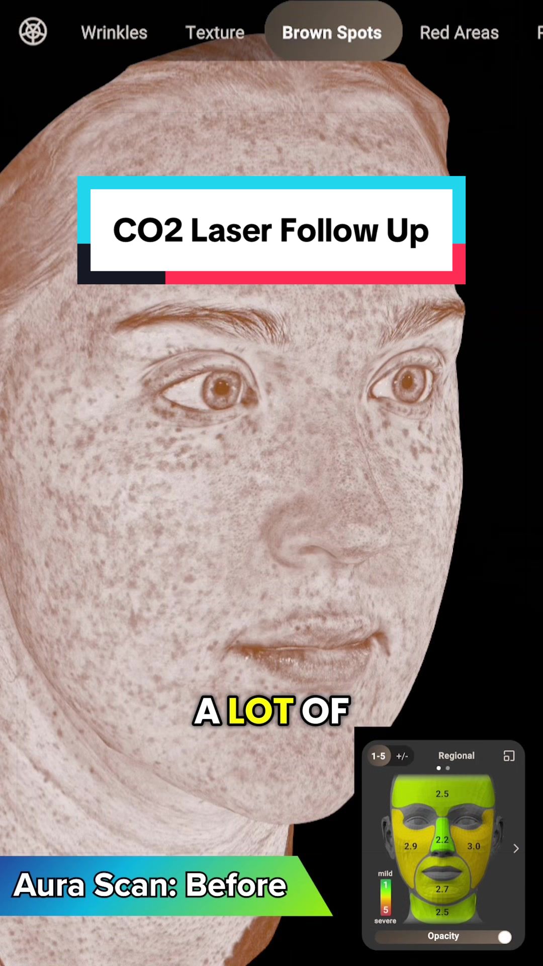 @Paul Phelps, MD