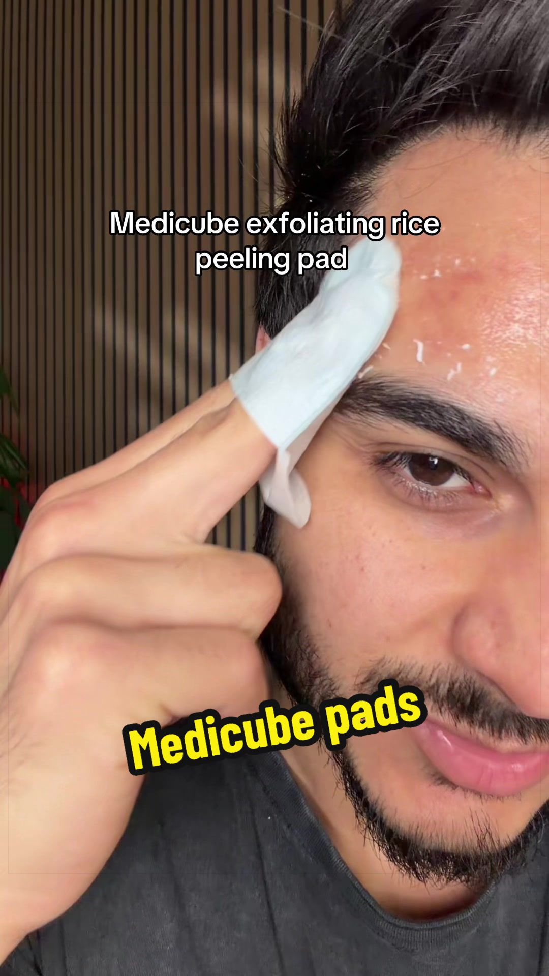 @Ferdieshops