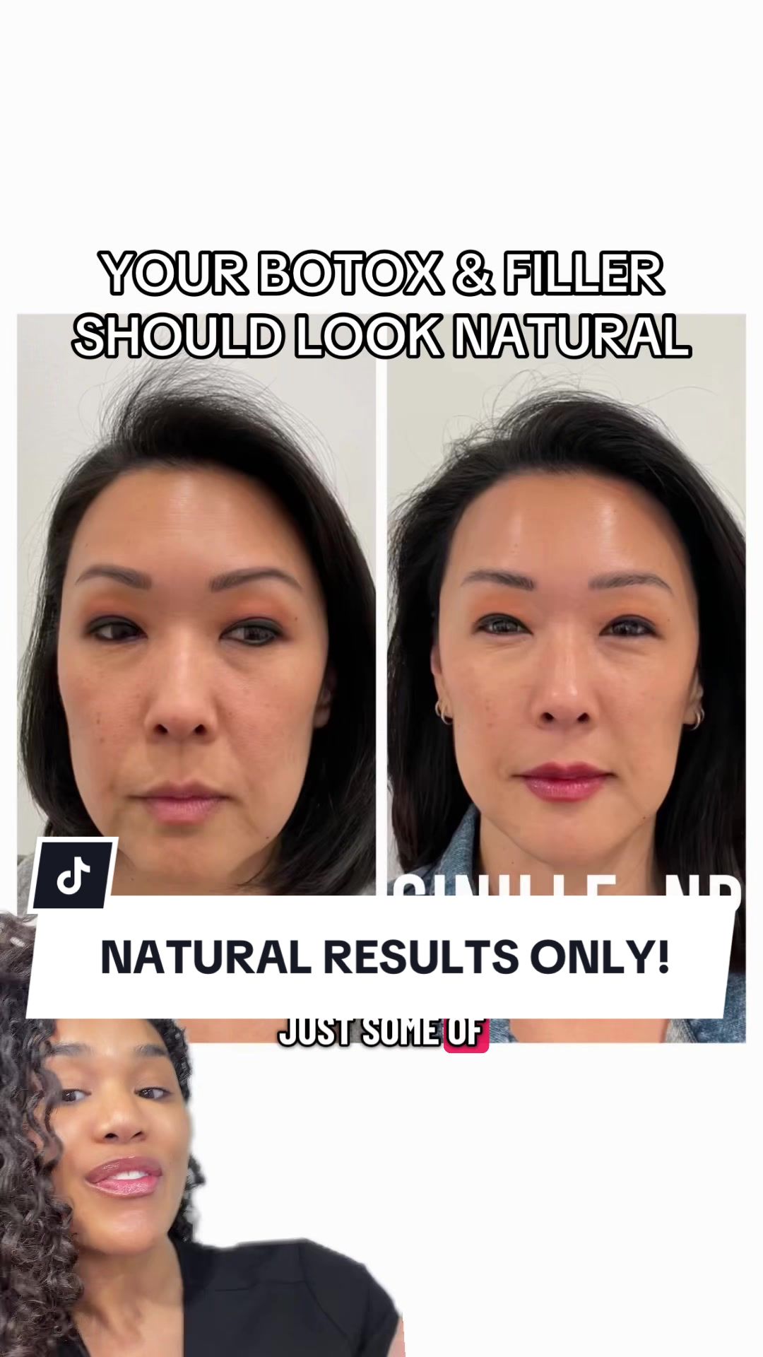 @Botox Filler Skin Los Angeles