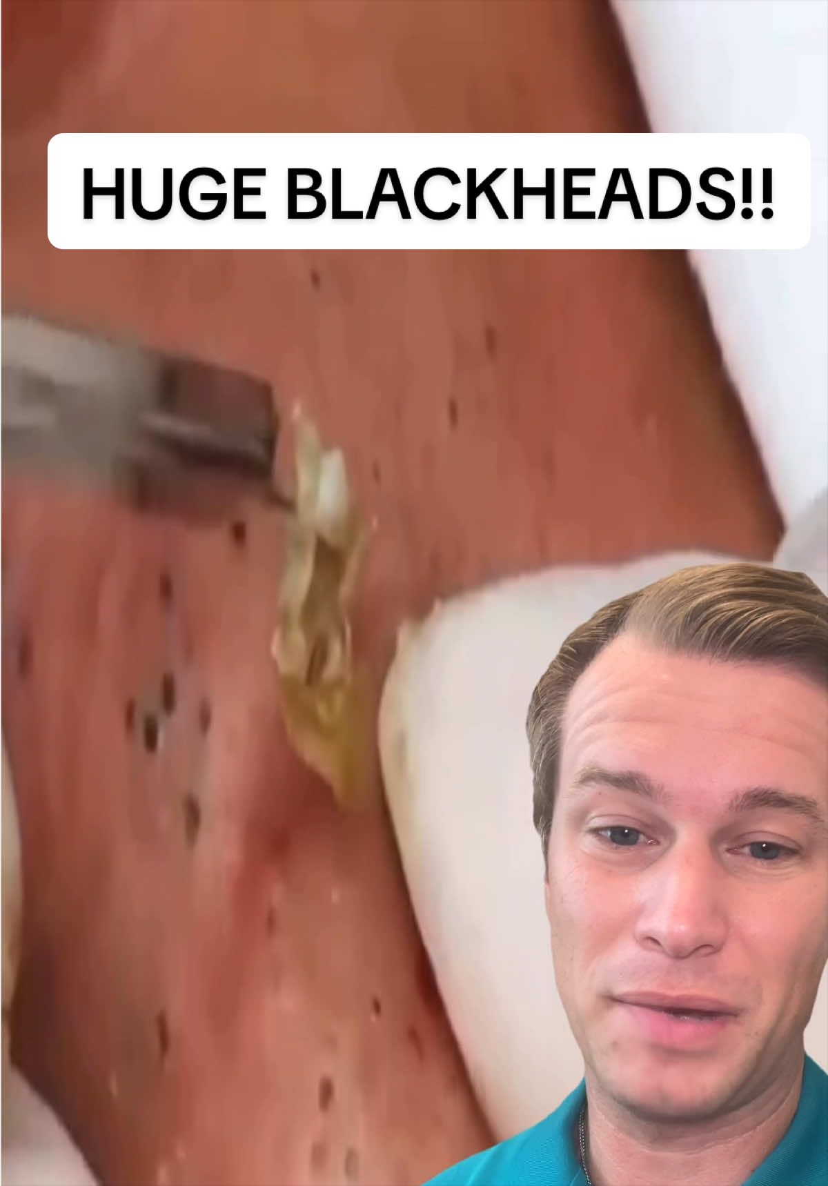 @AustinLeePA-C