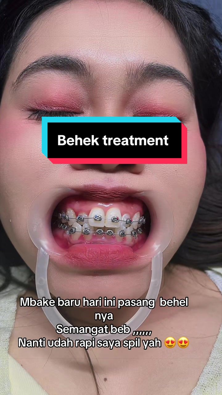 @mbak-Paijem