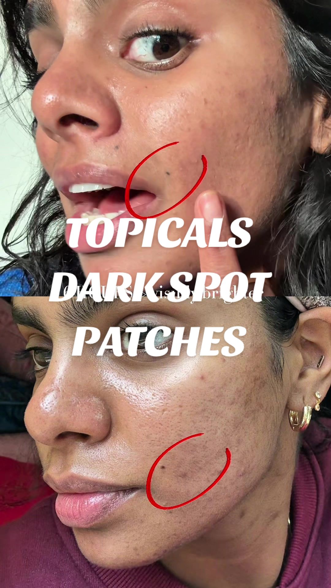 @Nyx Curations | Acne +Wellness