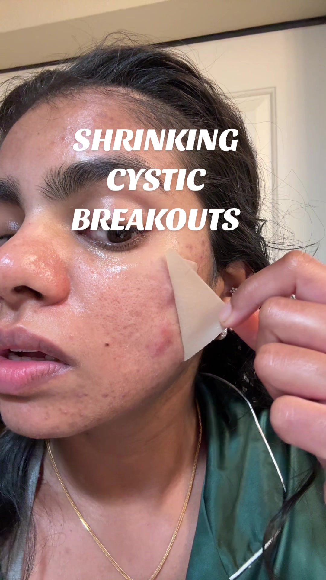 @Nyx Curations | Acne +Wellness
