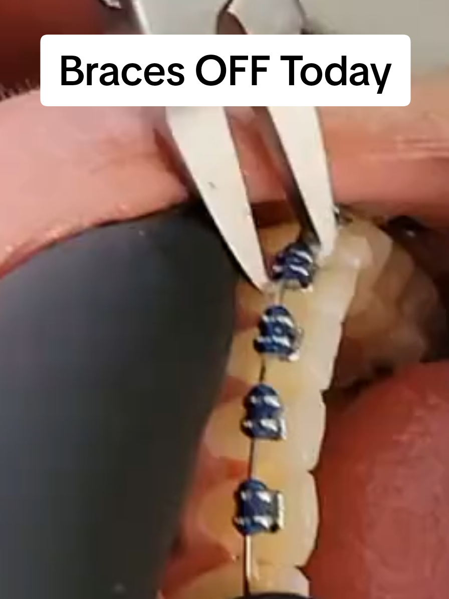 @SmileEnvyDental